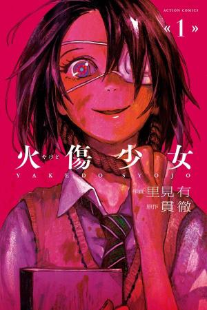 Yakedo Shoujo